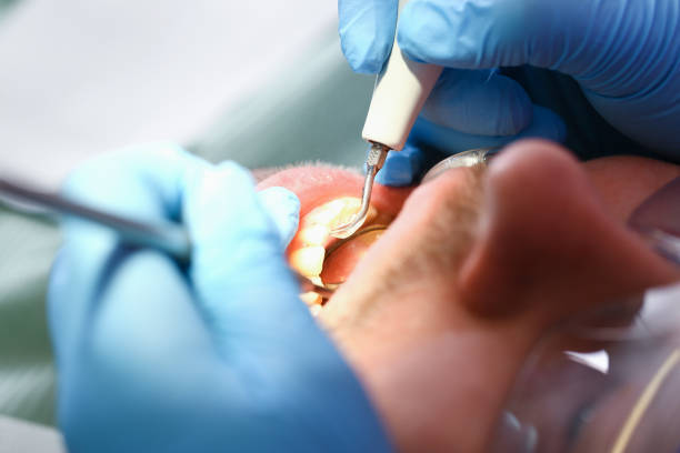 Best Emergency Treatment for Toothache in Springfield, KY