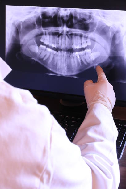 Best Emergency Treatment for Toothache in Springfield, KY